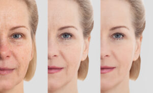 Anti Aging im Shop PureBIO